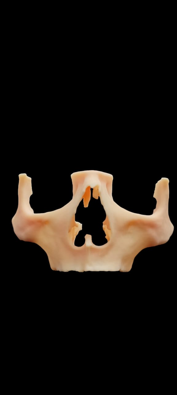 Biomodelo 3D de Maxila